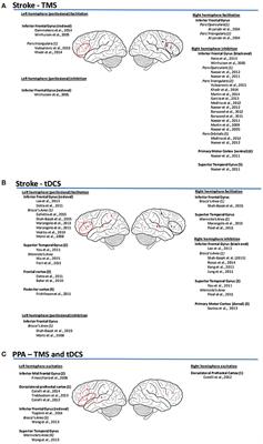Non-invasive Brain Stimulation in the Treatment of Post-stroke and Neurodegenerative Aphasia: Parallels, Differences, and Lessons Learned